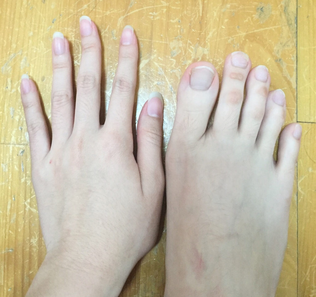 Девушка из Канады любит свои пальцы ног 