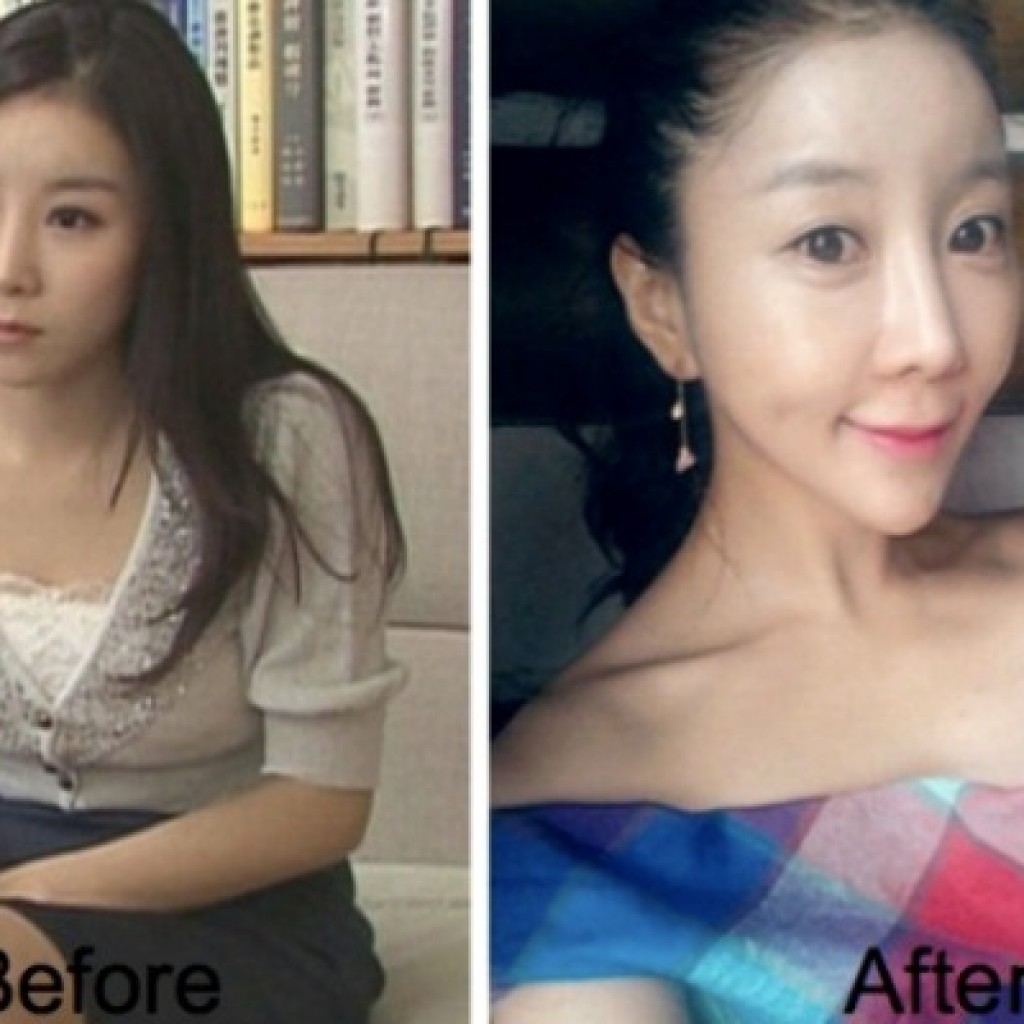 Asian doll plastic surgery