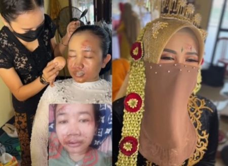 Sedih Pengantin Wanita Alami Kecelakan H 2 Pernikahan Wajahnya Penuh Luka Saat Dirias